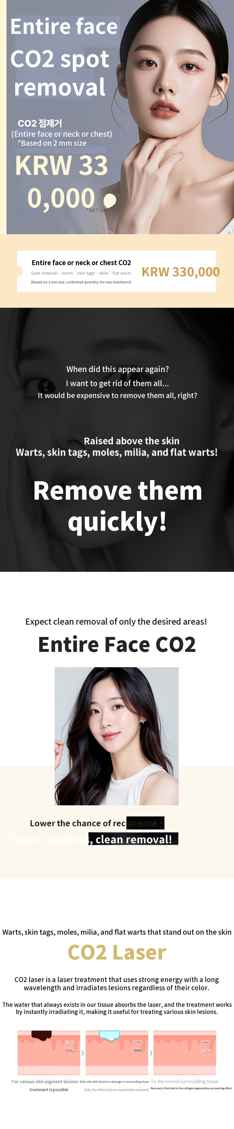 Suwon Mole, Skin Tag, Milia, Flat Wart CO2 Laser