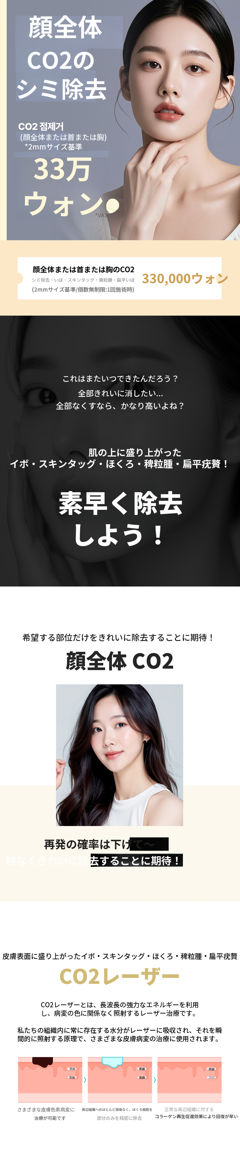 水原市のイボ、皮膚タグ、ミリオンクス、平坦疣贅 CO2レーザー
