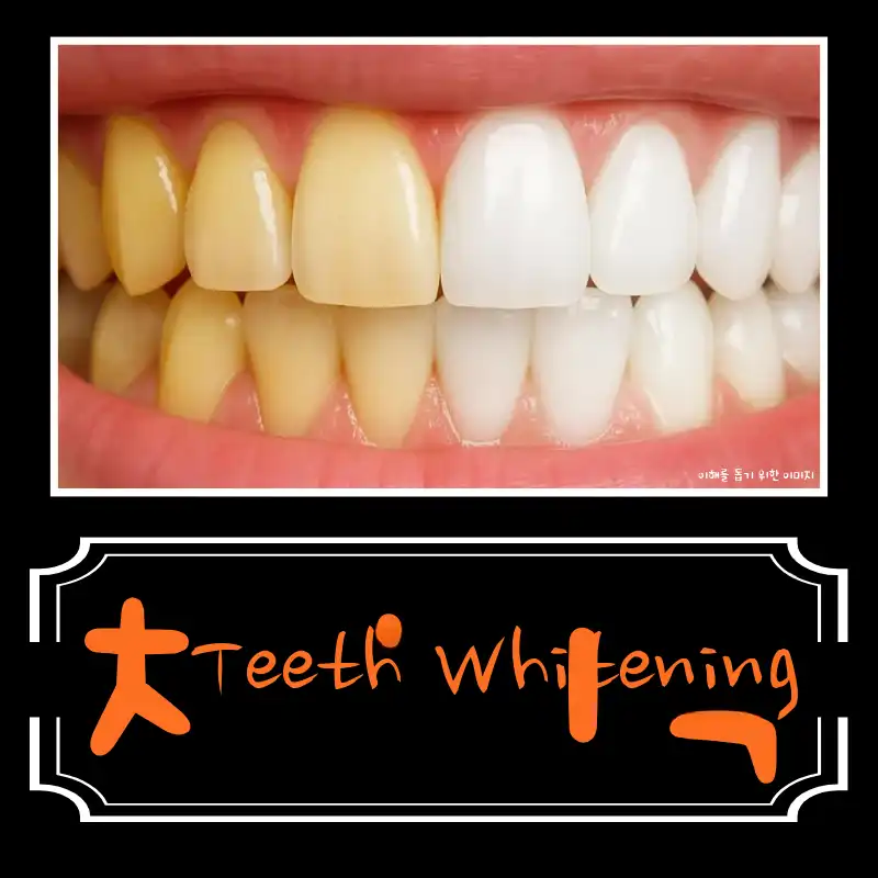 One-Day Teeth Whitening (3 times a day)