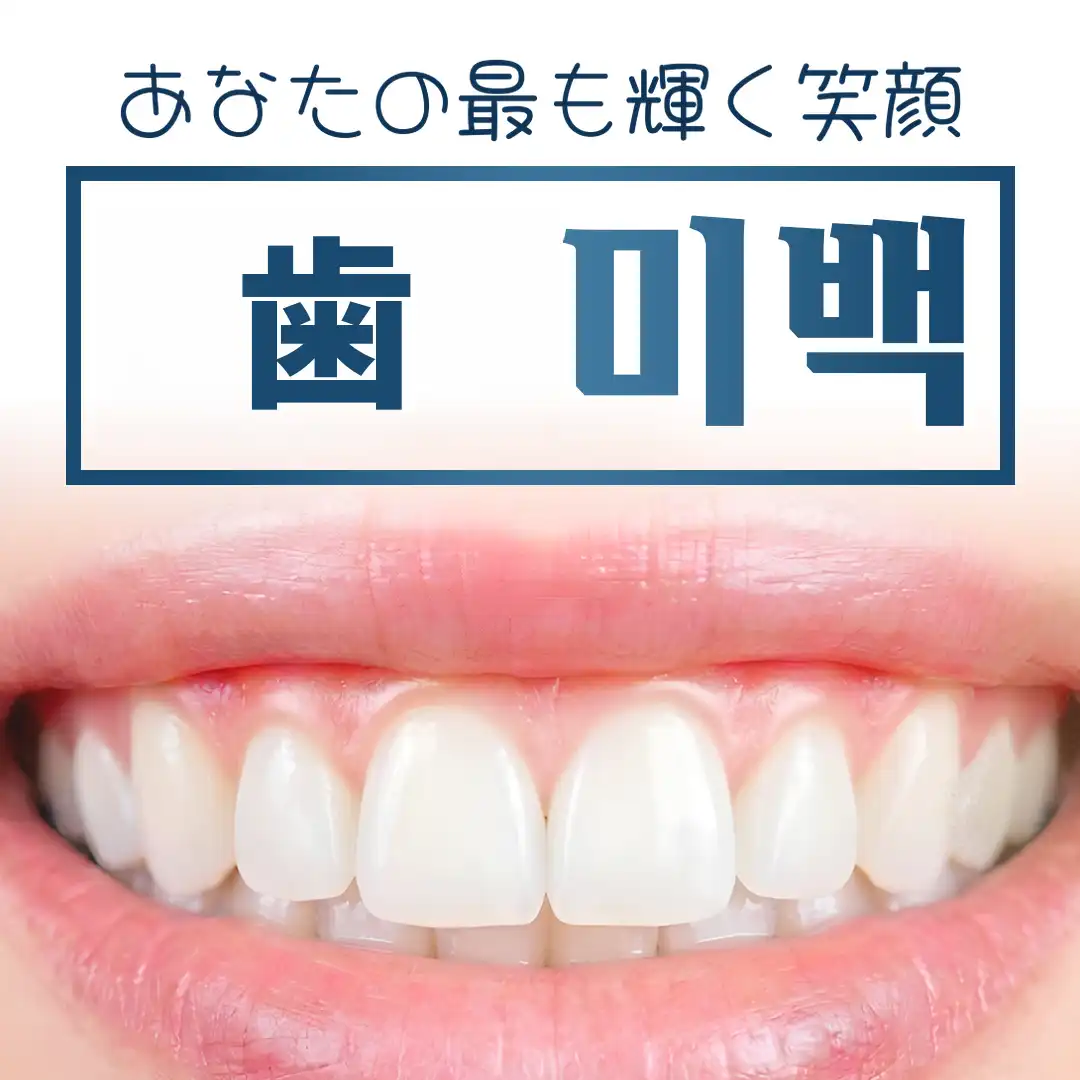 ワンデイ歯のホワイトニング（1日3回）