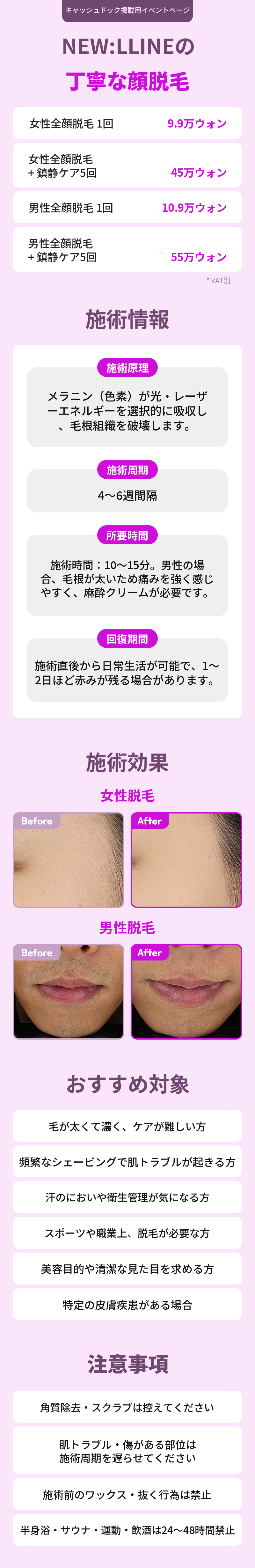 ニュエラインの細かい顔脱毛