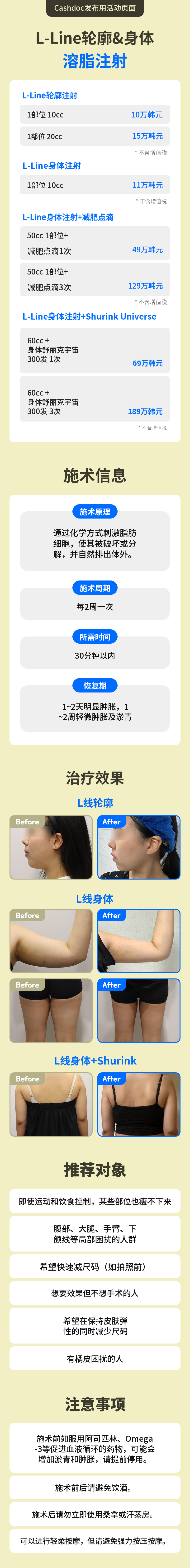 艾兰轮廓&身体脂肪分解注射