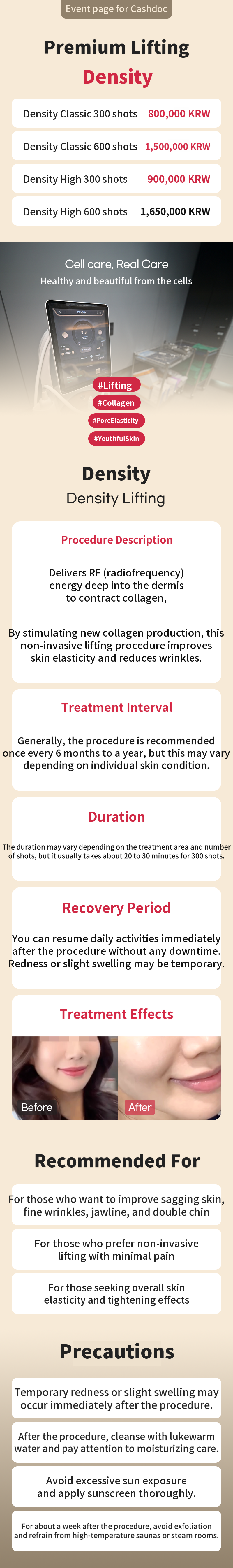 Lishubo Fat Extraction Injection without Compression Garment