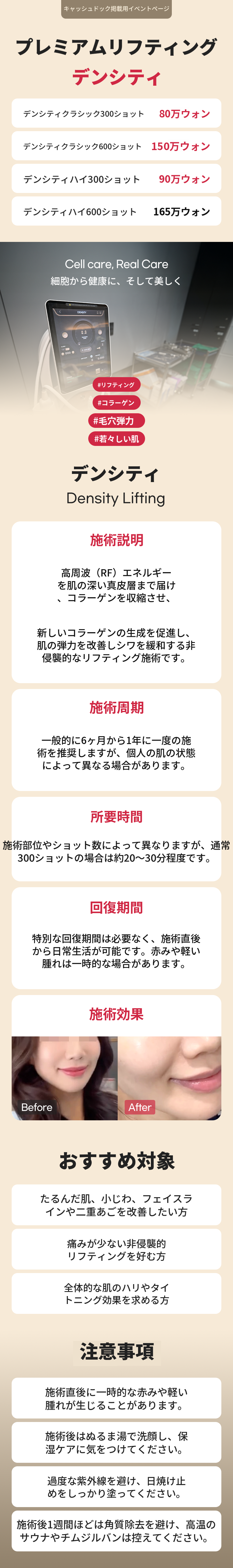 圧迫服なし、リシュボ脂肪抽出注射