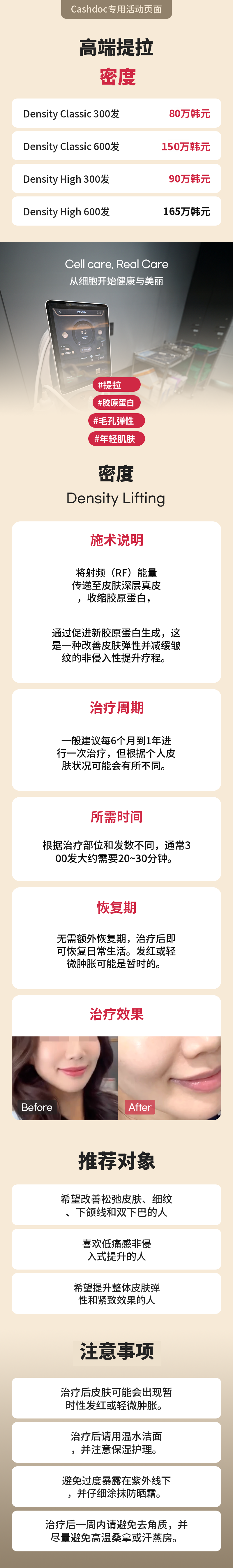 无需压迫衣,Lishubo 脂肪抽取注射