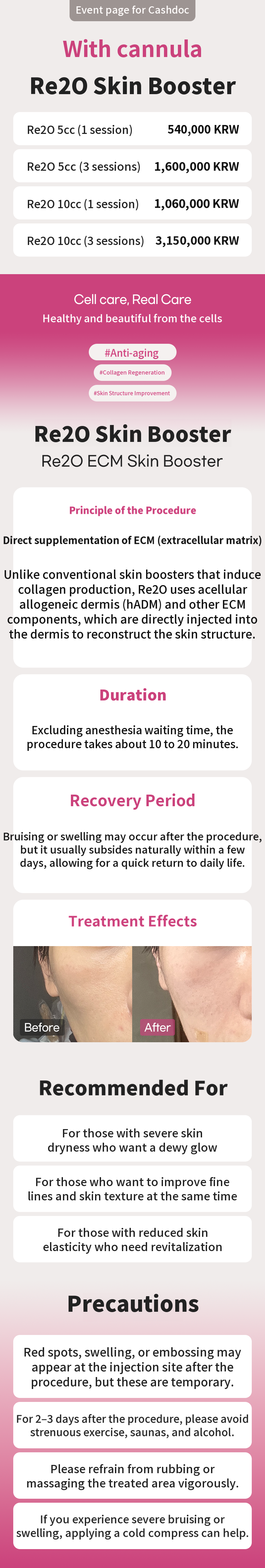 [With Cannula] Lituo Skin Booster