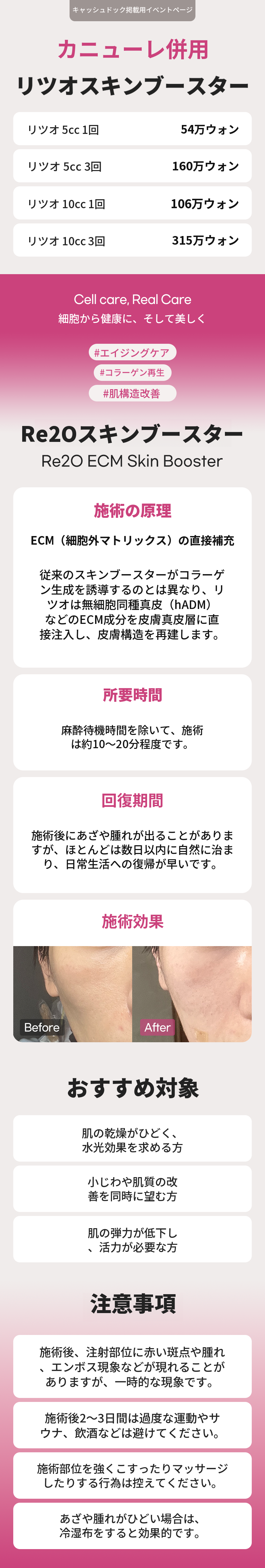 [カニューレ併用] リトゥオ スキンブースター