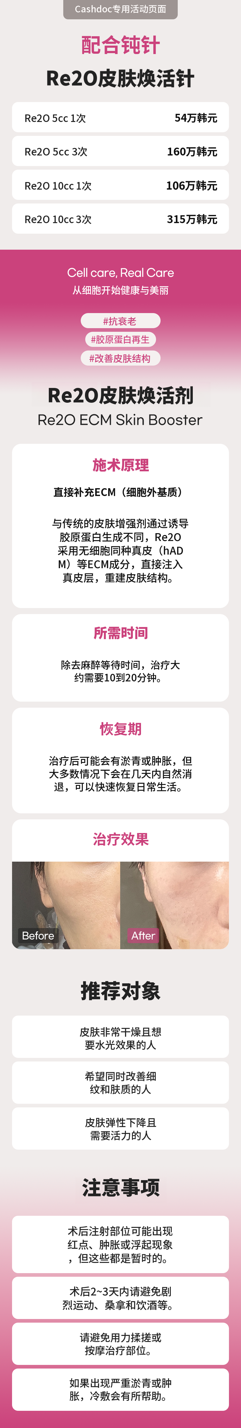 [与导管并行] Rituo皮肤增强剂