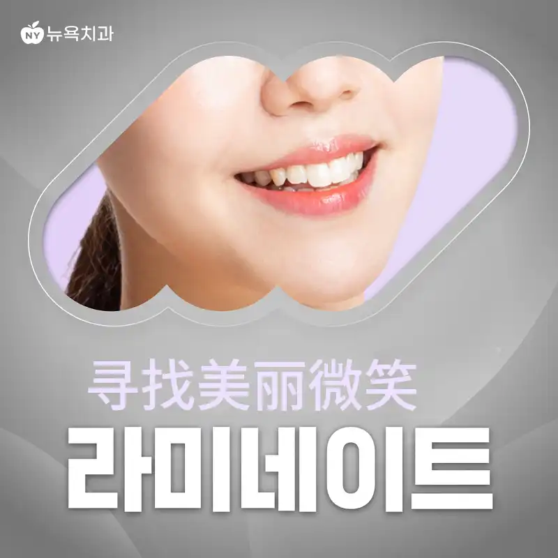 寻找美丽微笑的贴面牙