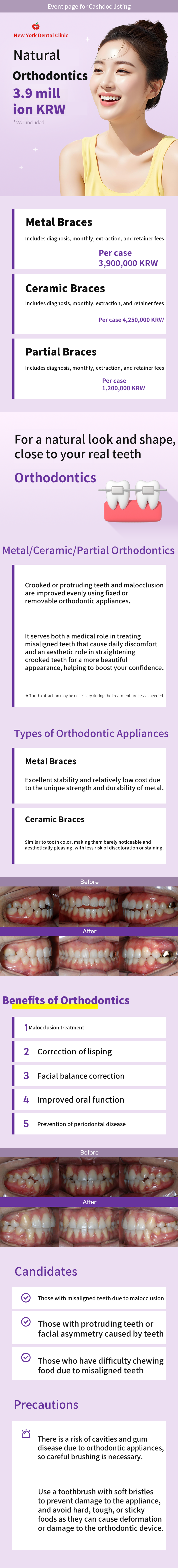 Natural Teeth Alignment