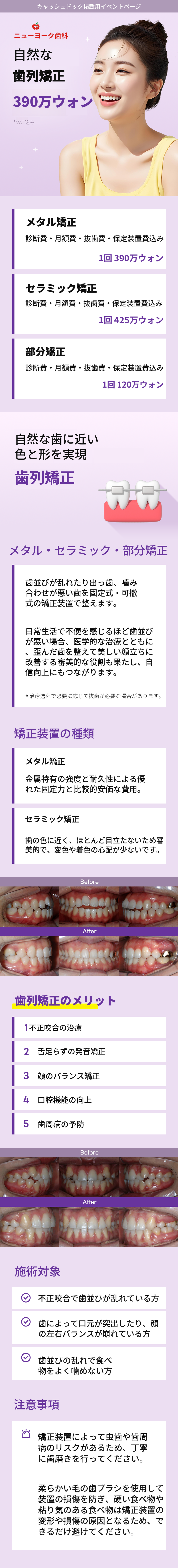 自然な歯の矯正