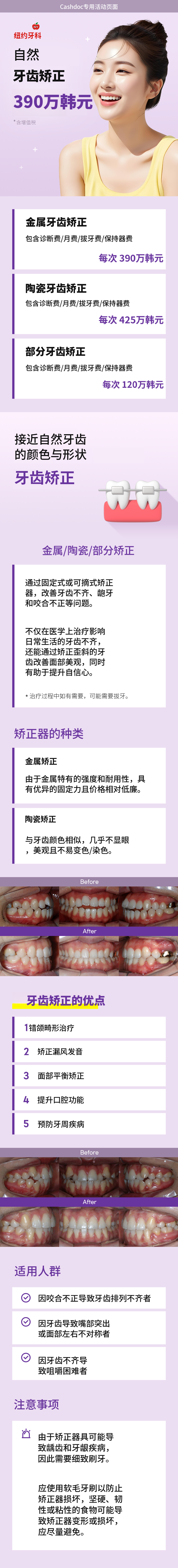 自然牙齿矫正