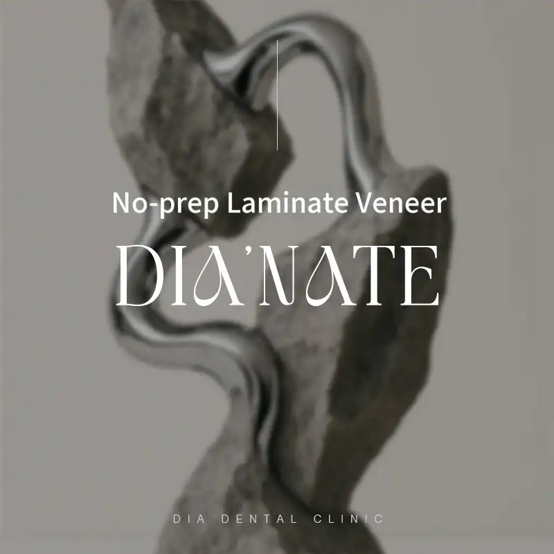 Non-Prep Laminate, Dianate