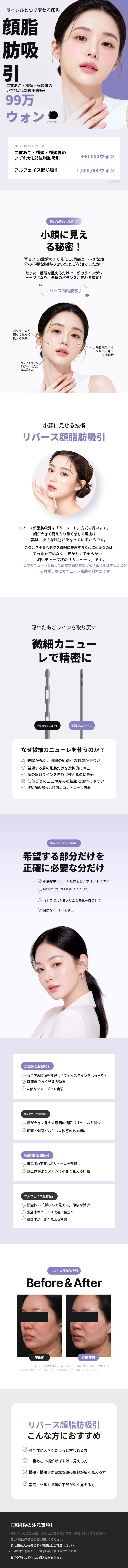 イルサン顔脂肪吸引EVENT