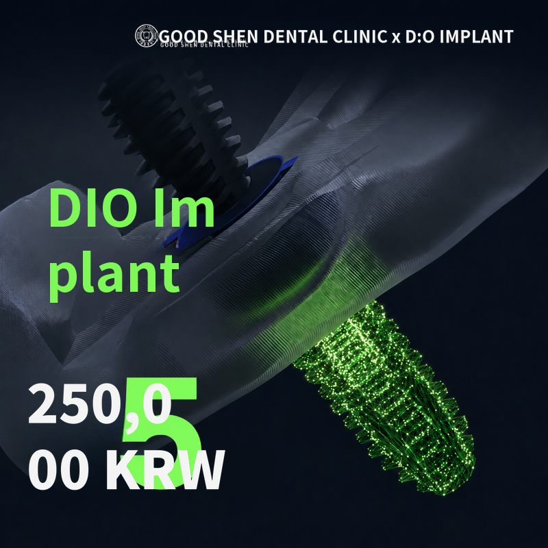 GoodSense Dio Implant