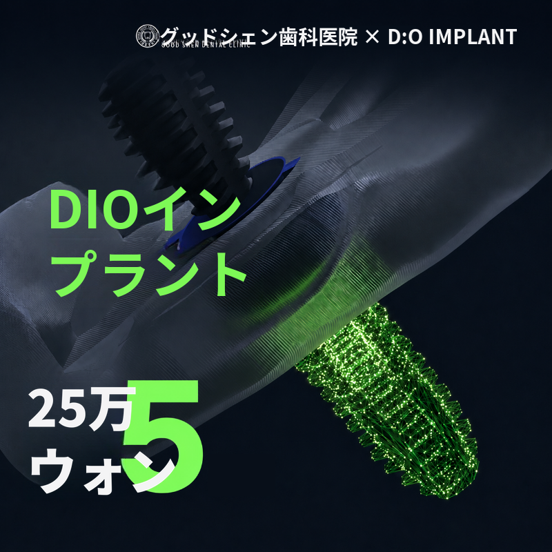 グッドセンインプラント