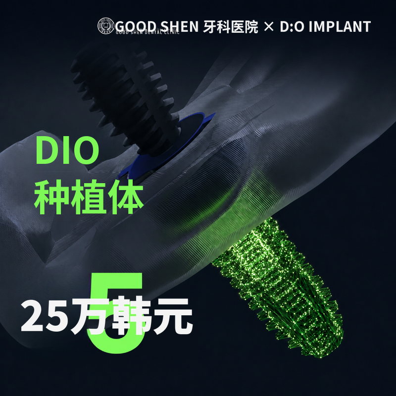 Goodson DIAM Implant