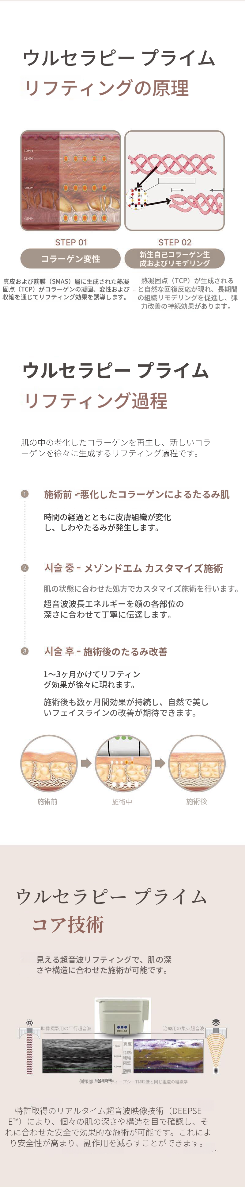 ウルセラピー プライム
