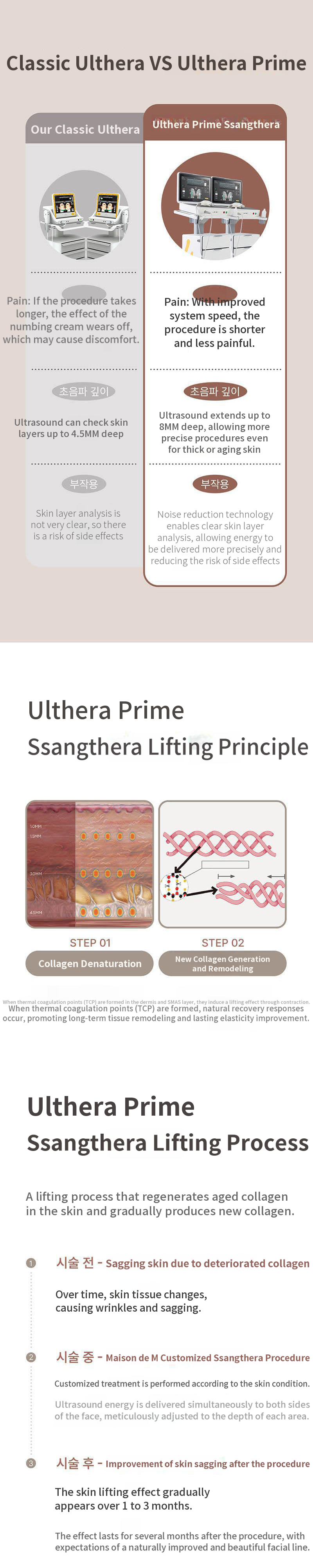 Ultherapy Prime Dual Treatment