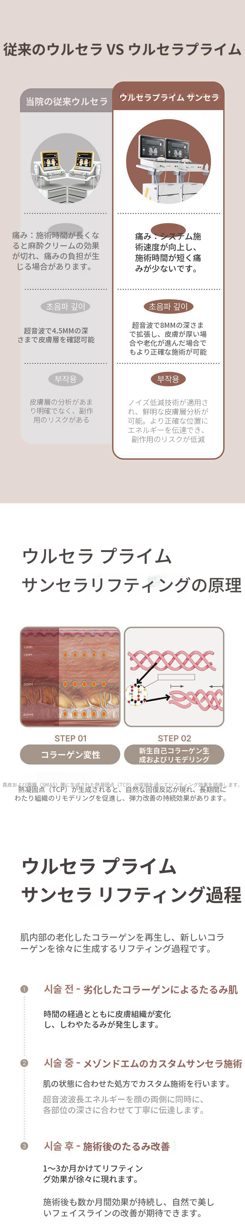 ウルセラピー プライム ダブルセラ
