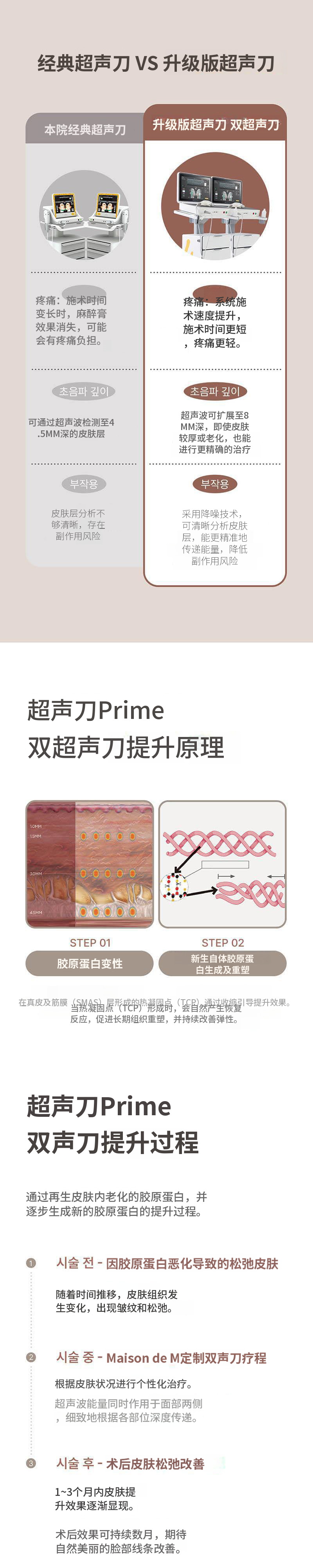 Ultherapy Prime双重提升
