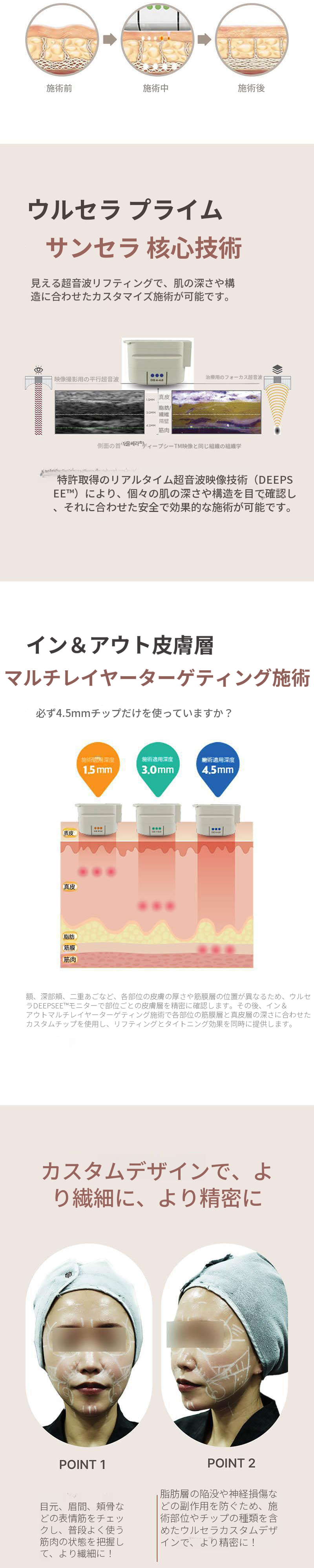 ウルセラピー プライム ダブルセラ