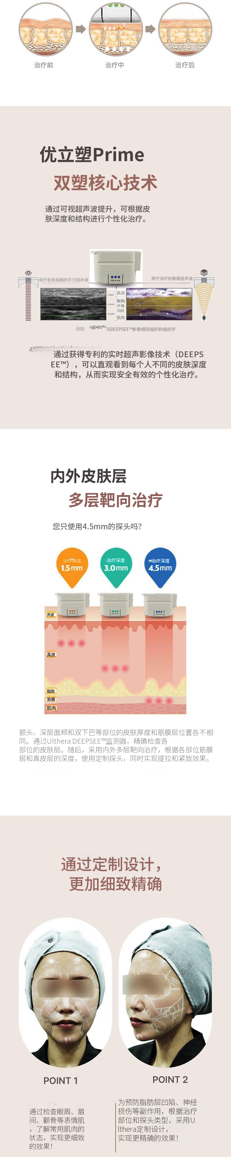 Ultherapy Prime双重提升