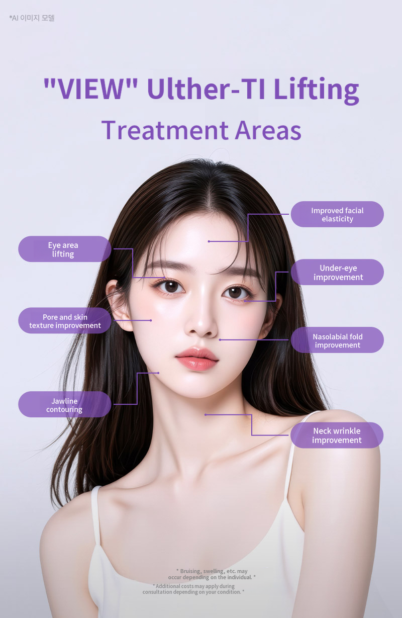 ❤View❤Ultherapy Lift (Sleep Anesthesia)