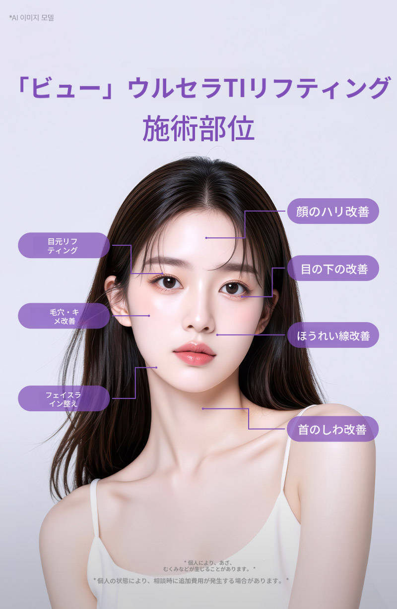 ❤ビュ❤ウルソリフト(睡眠麻酔)