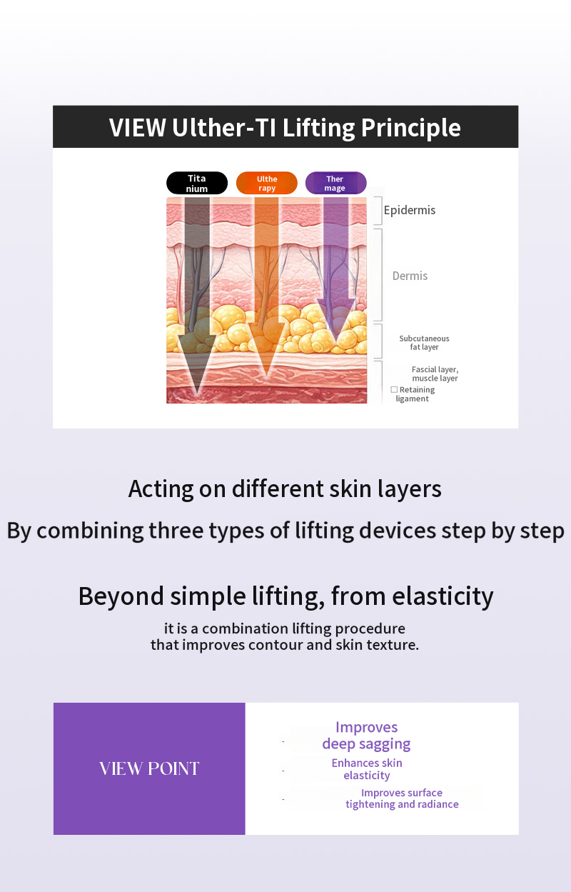 ❤View❤Ultherapy Lift (Sleep Anesthesia)