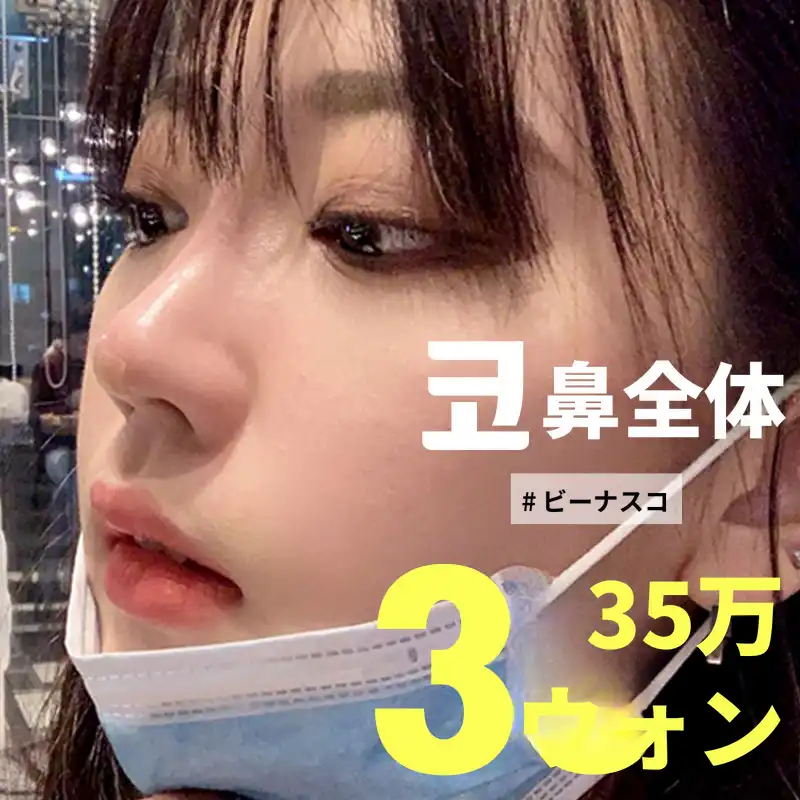 ハイコ コフィラー、ビーナスコ