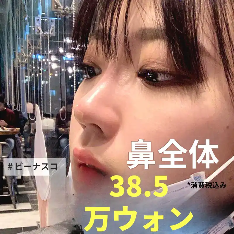 ハイコ コフィラー、ビーナスコ