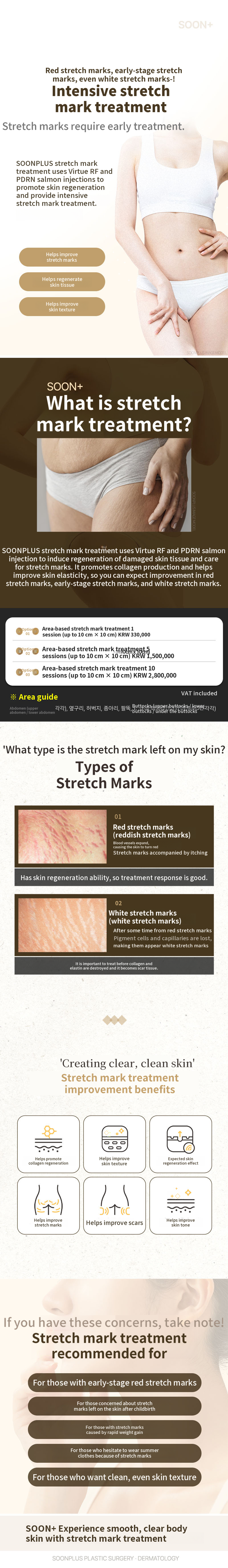 Sun Plus Stretch Mark Treatment Stretch Mark Laser Stretch Mark Injection