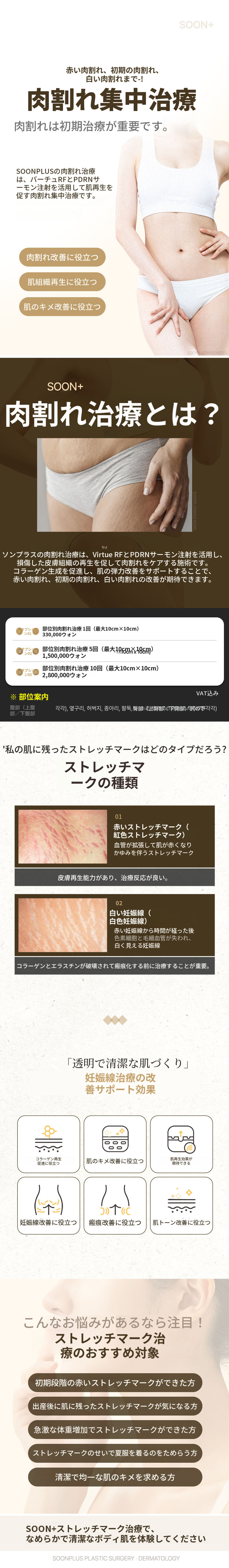 スンプラス_妊娠線治療 妊娠線レーザー 妊娠線注射