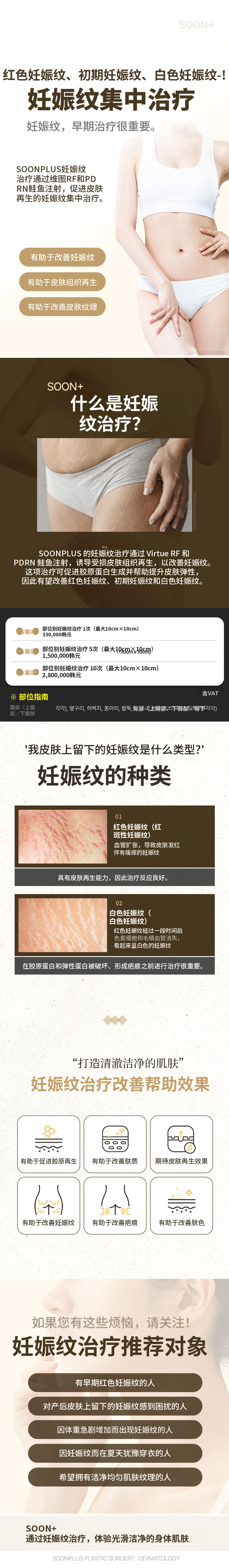 顺普拉斯_妊娠纹治疗 妊娠纹激光 妊娠纹注射