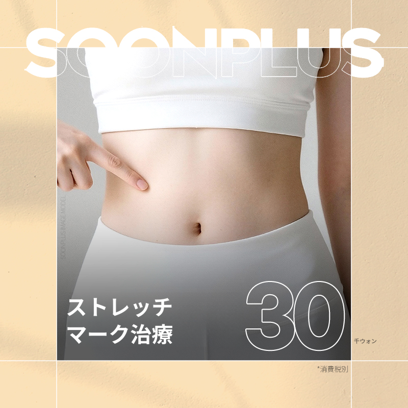 スンプラス_妊娠線治療 妊娠線レーザー 妊娠線注射