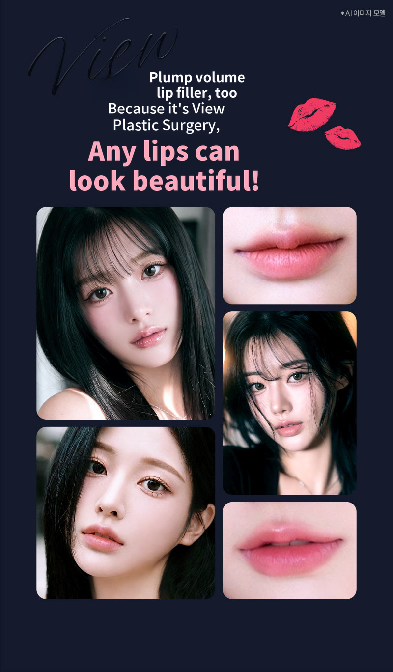 ❤View❤Restylane Lip Filler, Lip Corner Filler