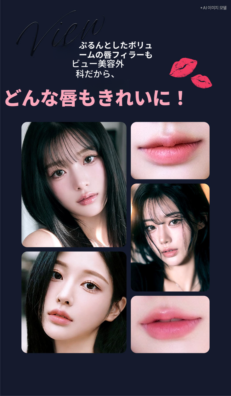 ❤ビュ❤レスタレーンリップフィラー、口角フィラー