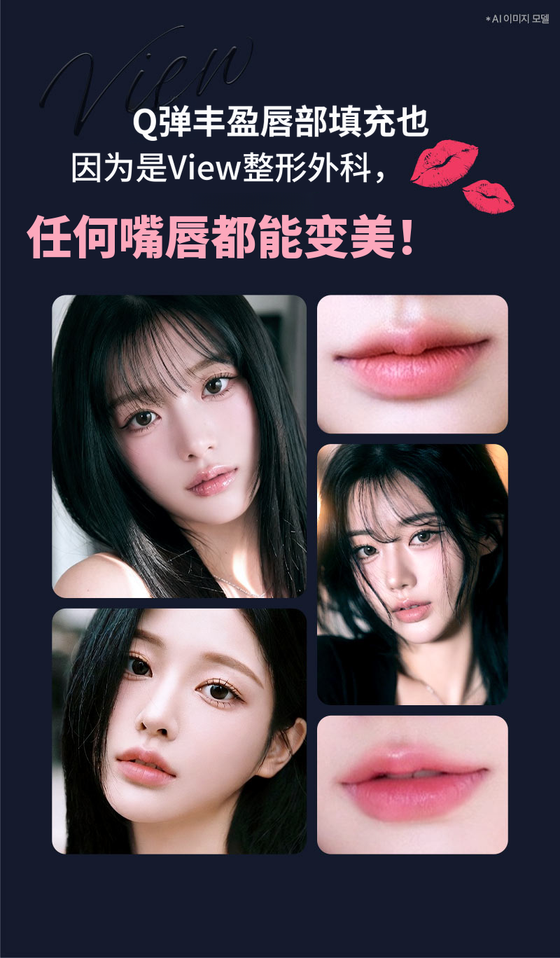 ❤视❤瑞士玻尿酸唇部填充剂, 口角填充剂