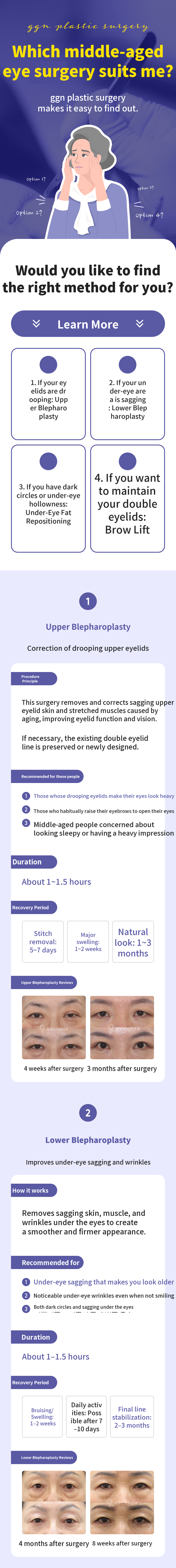 [Cashdoc Exclusive] Premium Middle-Aged Eye Surgery