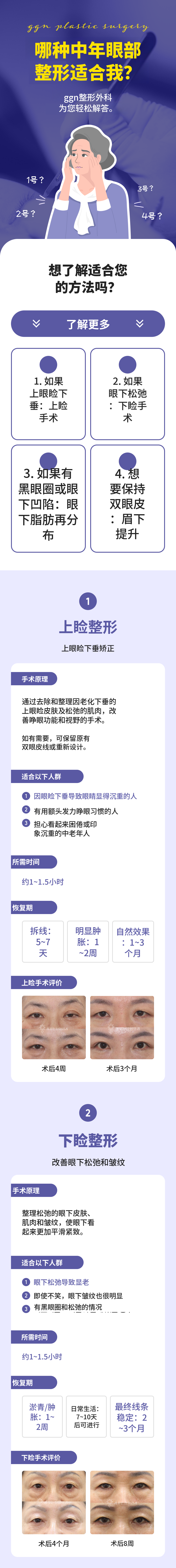 [现金独占] 高级中年眼整形