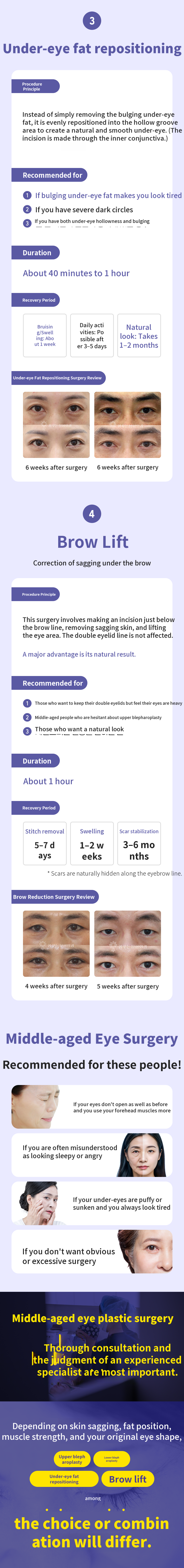 [Cashdoc Exclusive] Premium Middle-Aged Eye Surgery