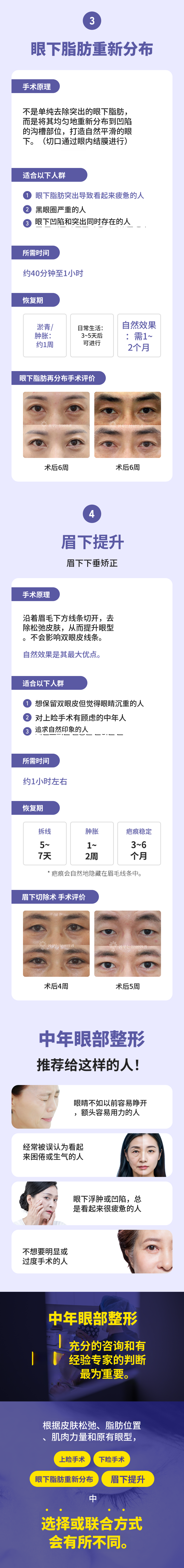 [现金独占] 高级中年眼整形