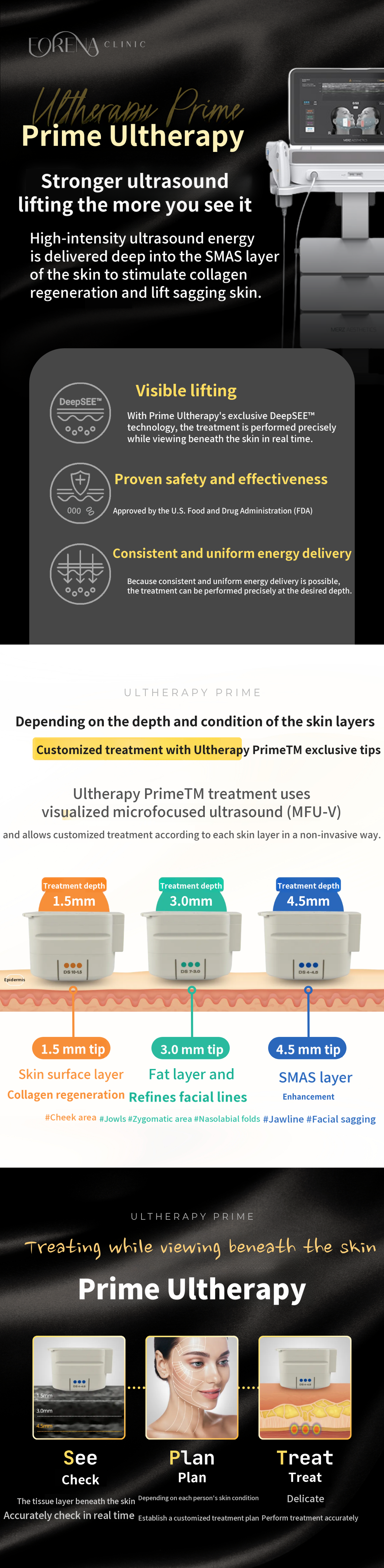 Hondae Station Ultherapy Prime