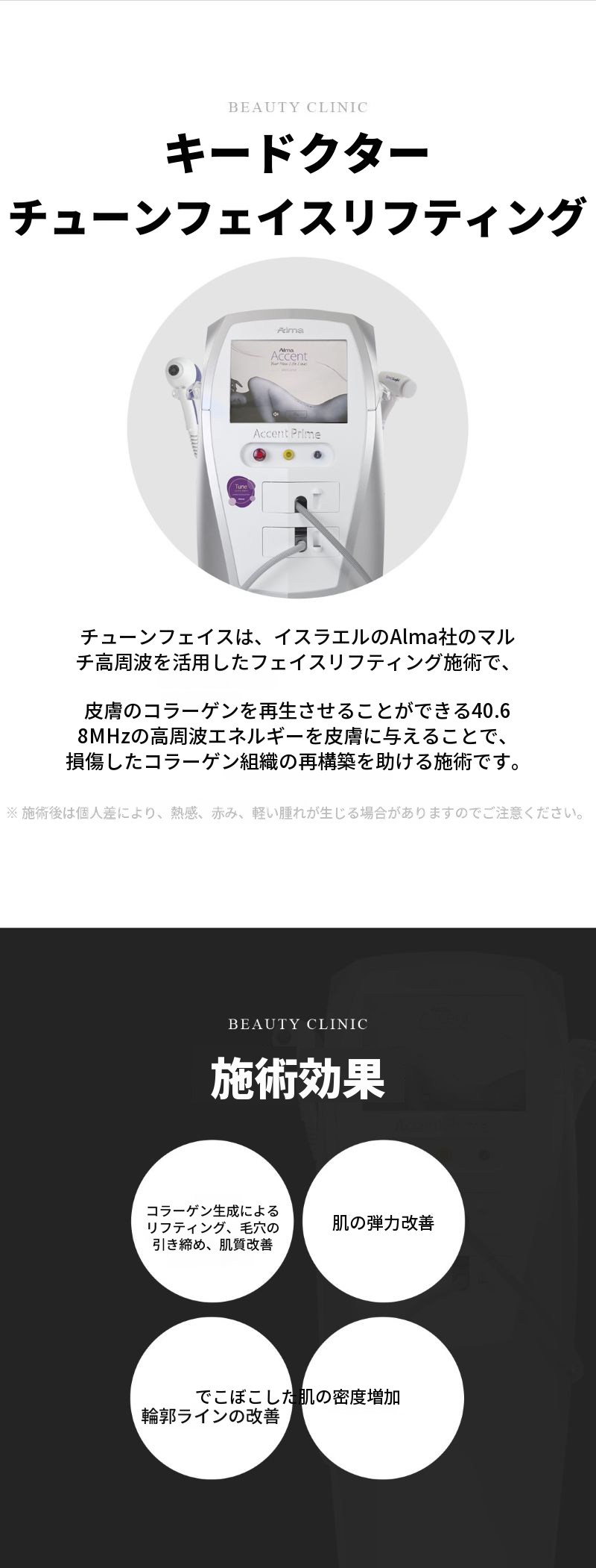 オルフィチェ チューンライナー