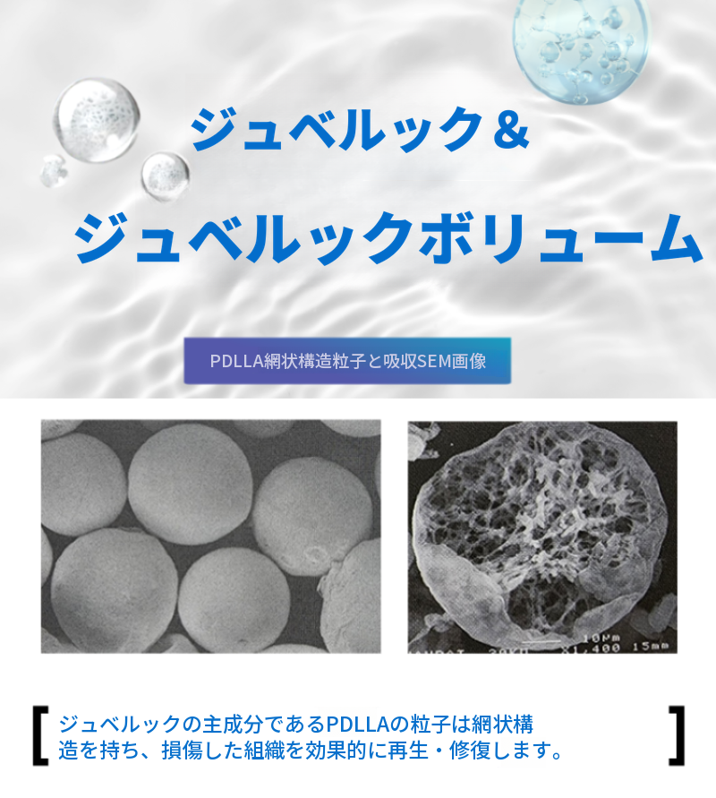 オルピチャジュベルック、ジュベルックボリューム、ジュベルックアイ
