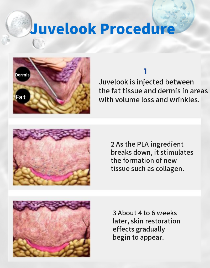 Olpech Juvelook, Juvelook Volume, Juvelook Eye