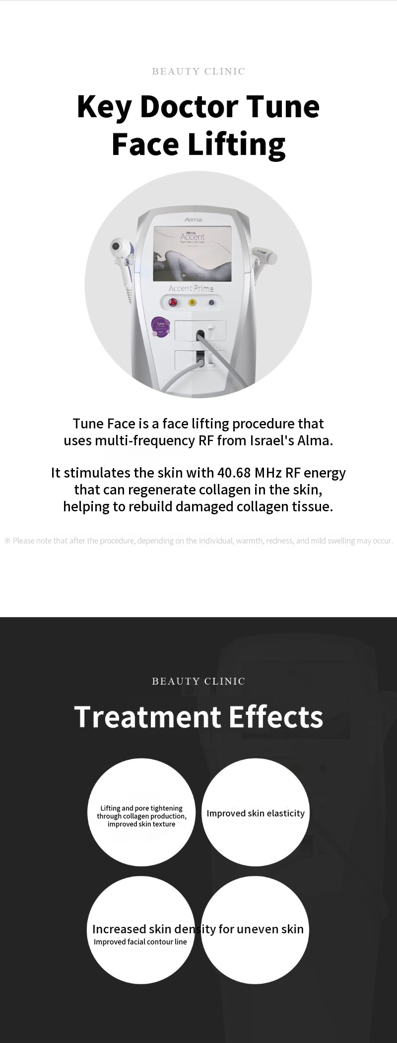 Alfi-Chai Tune Face Lifting