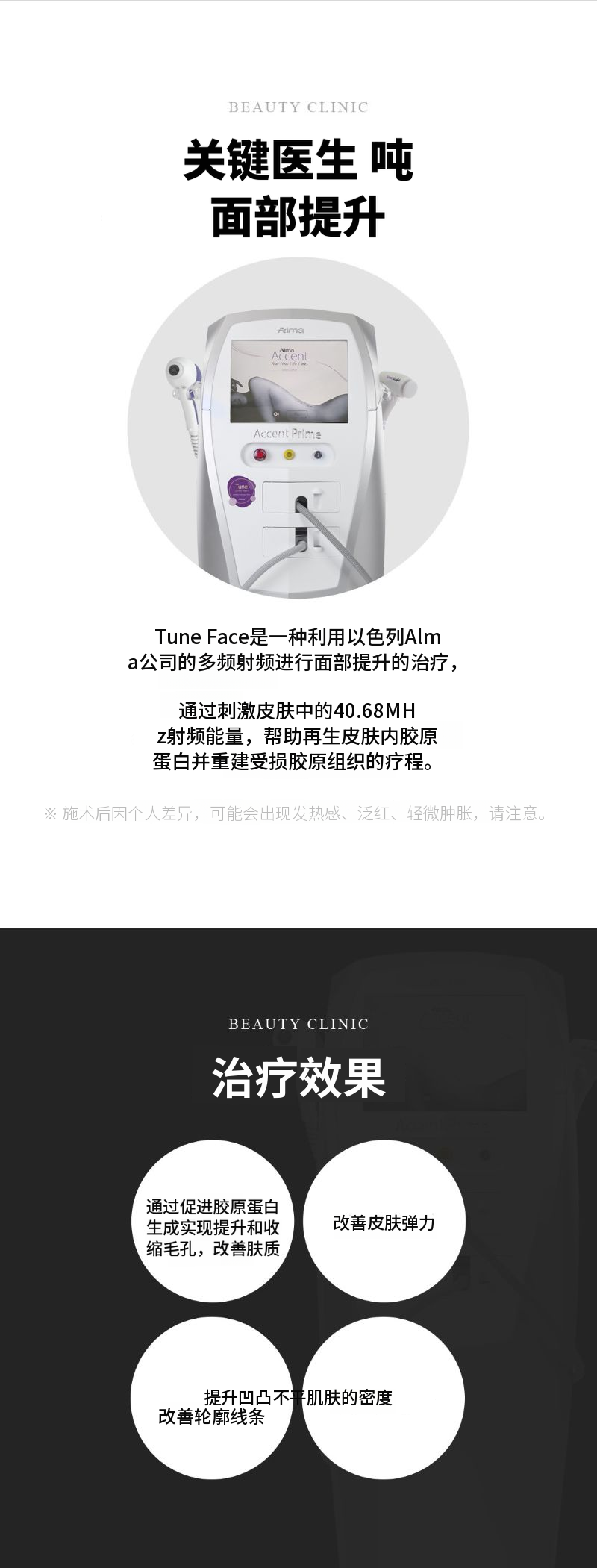 全脸提升