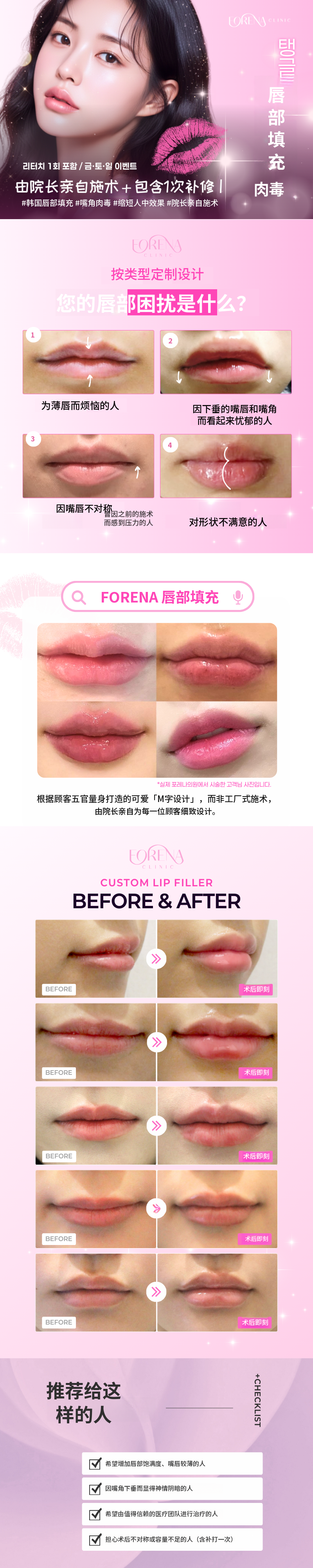 唇部填充剂+嘴角肉毒杆菌[1次修复]
